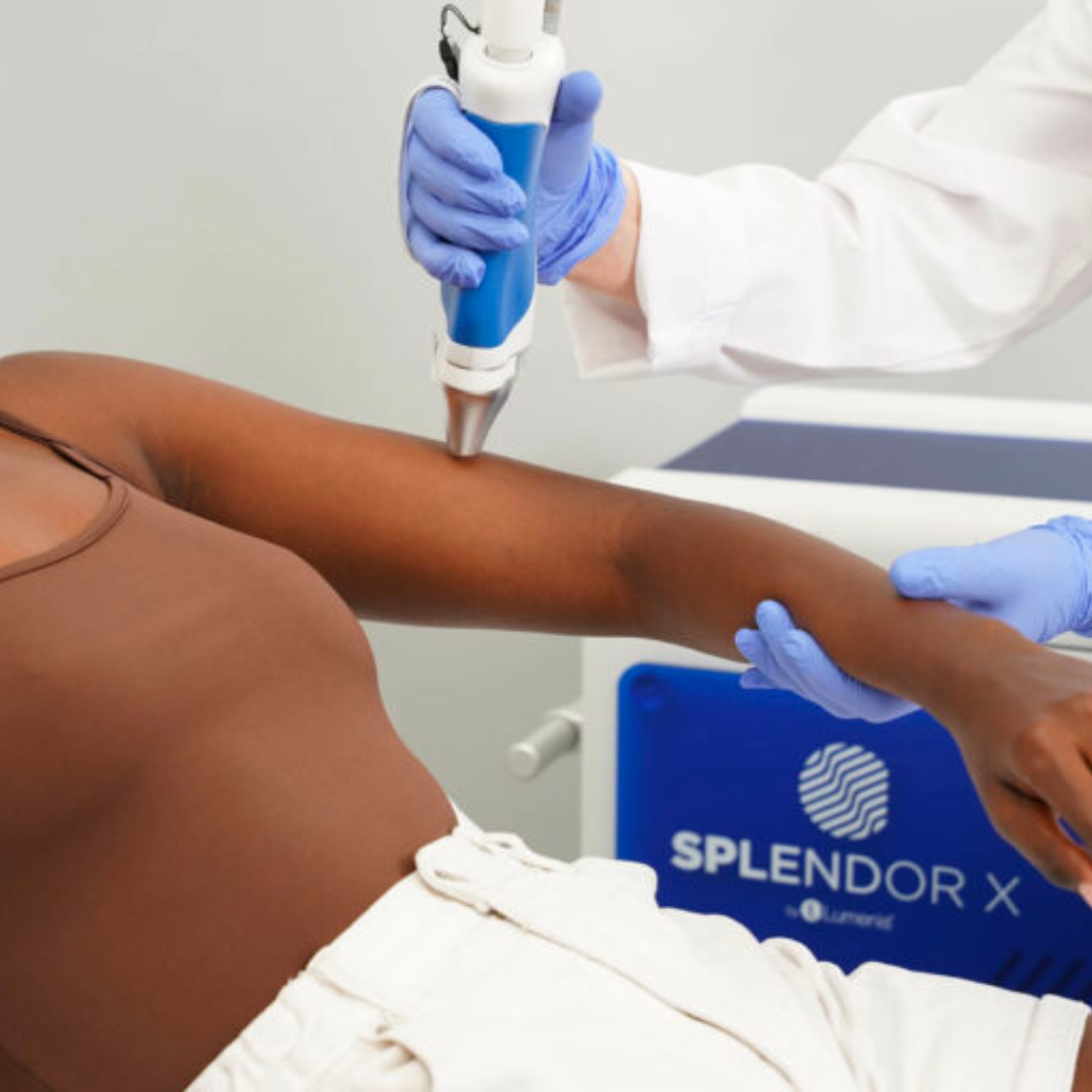 laser hair removal ARM